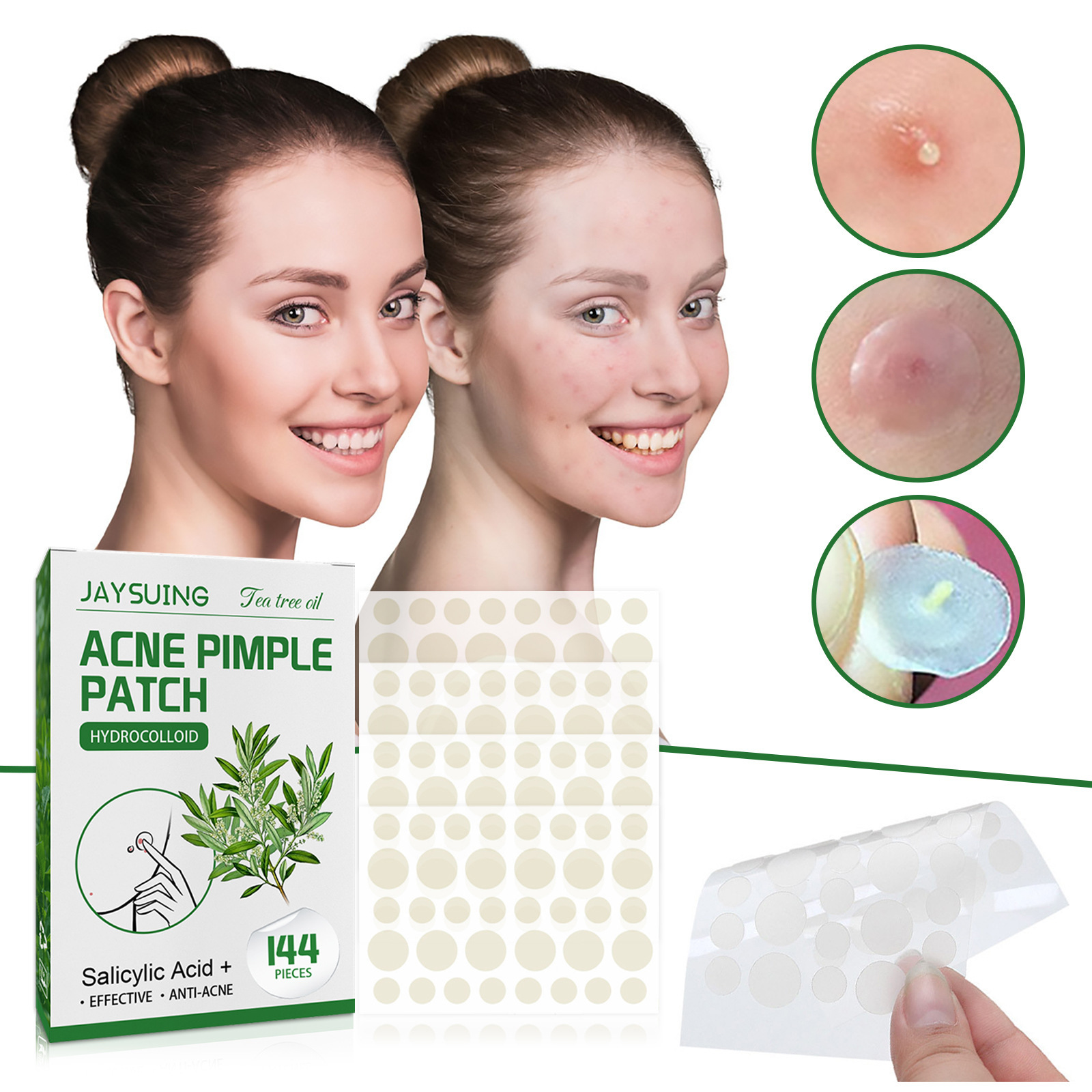 ハイドロコロイドニキビパッチ - 膿や油を吸収し、赤みを軽減 - Hydrocolloid Pimple Patch のレビューと価格